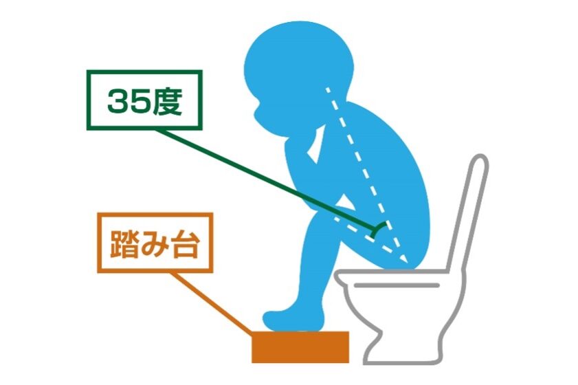 残便感があるのはなぜか？原因と対策を解説